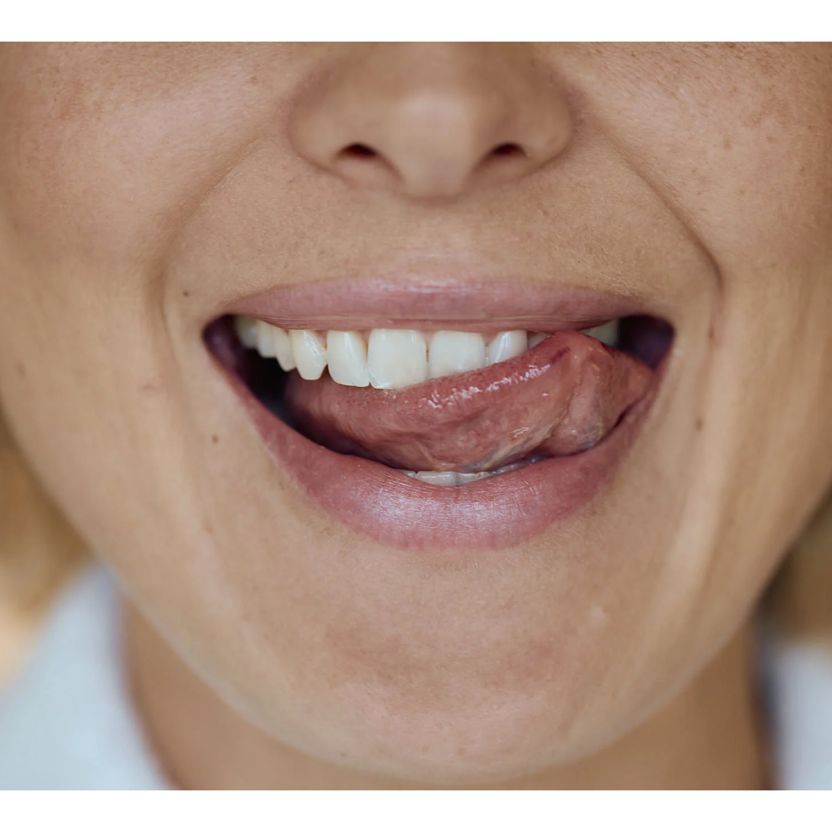 Close-up of a smile with healthy teeth and gums